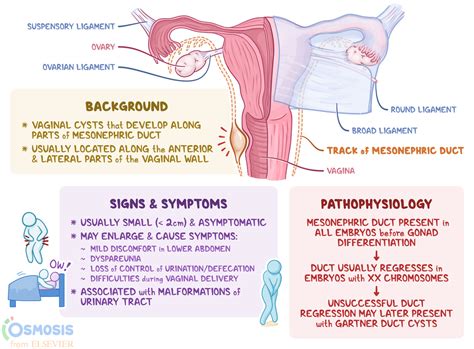 inflammation glande de skene|Skenes Glands: Purpose, Health Complications, and。